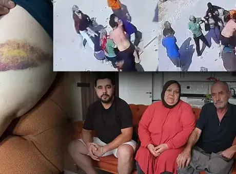 Zincir, keser, sopa ve bıçak... İki ailenin meydan savaşı: Mangal yapıp bize gıcıklık veriyorlar