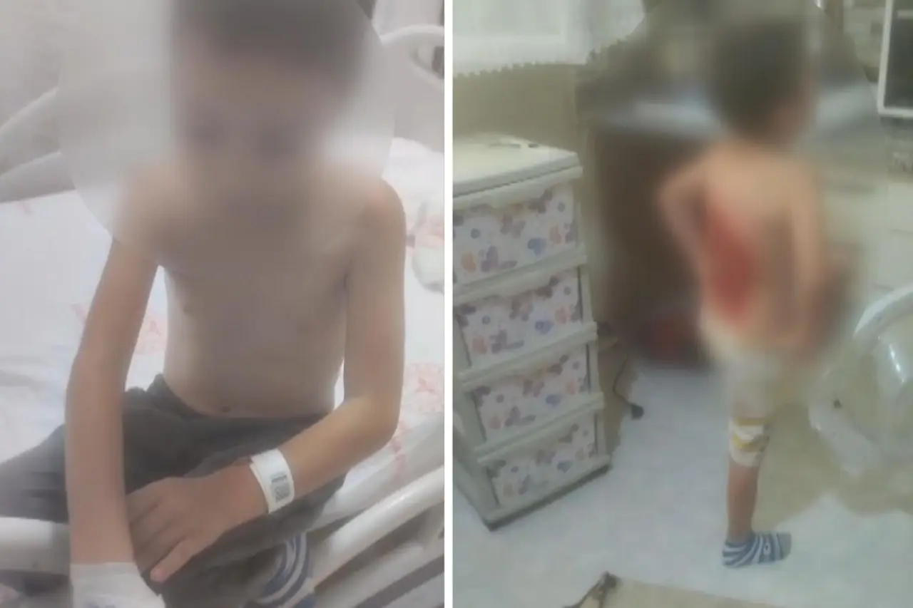 Arnavutköy'de akran şiddeti: 12 yaşındaki çocuğu kolonya döküp ateşe verdiler