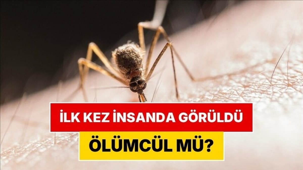 Shamonda Virüsü Nedir, Ölümcül mü? Shamonda Belirtileri Neler?