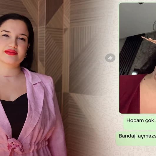 Estetik işlem kabusa döndü! Gıdı operasyonu sonrası boynu şişti, yoğun bakıma kaldırıldı: 5 milyon TL tazminat istedi